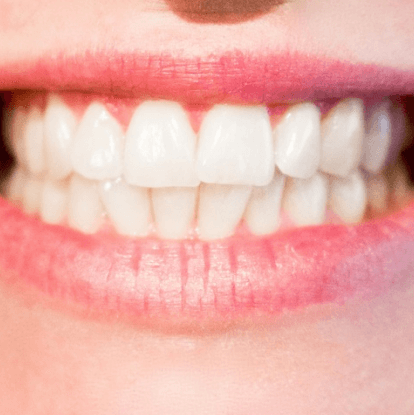 Did You Know These Food Items Could Be the Culprits Behind Bad Breath?